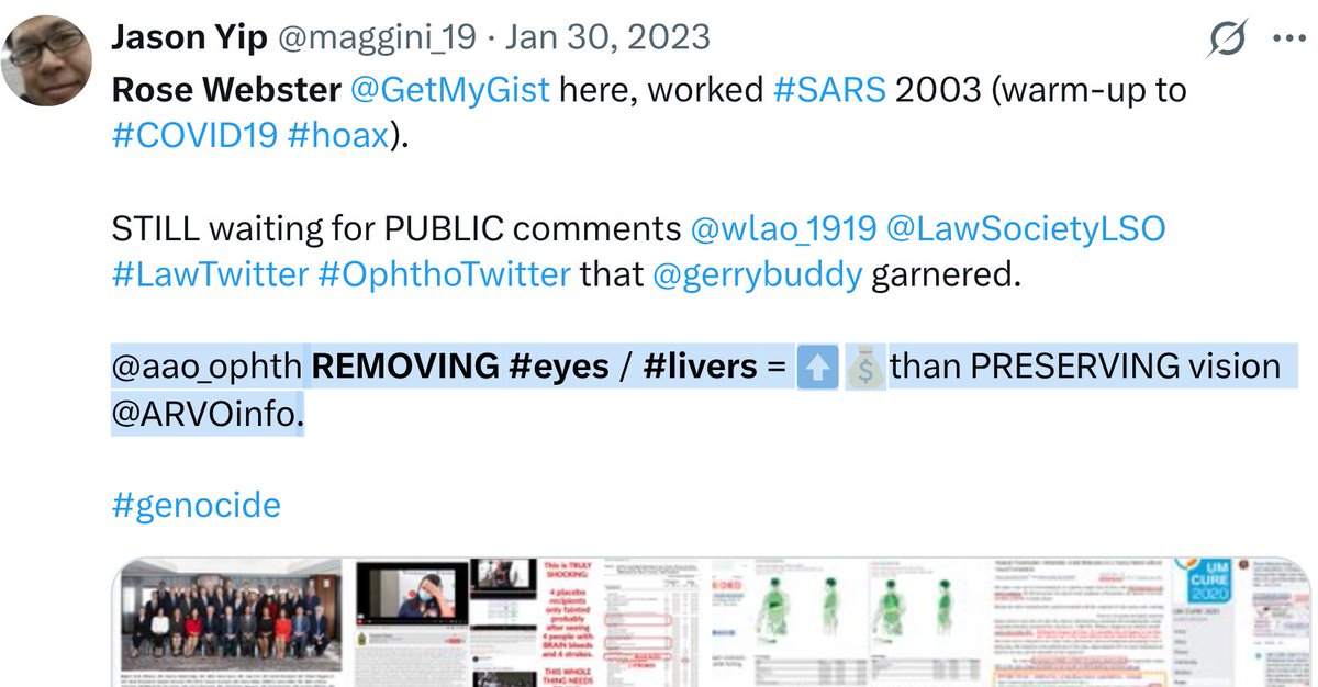maggini_19's tweet image. Rose Webster @GetMyGist here ♀️🇨🇦. Dear .@DebiEvansMatron, I was a 90s #nursing #student, #Prosthetics 🎓(clinical @Sunnybrook), fmr .@JCAHPO COA at 4 🏥, ✍️few modules for .@OntPharmacists  etc. 

Short A:
💰became MORE important than #DoNoHarm #InformedConsent, Risk v Benefit.