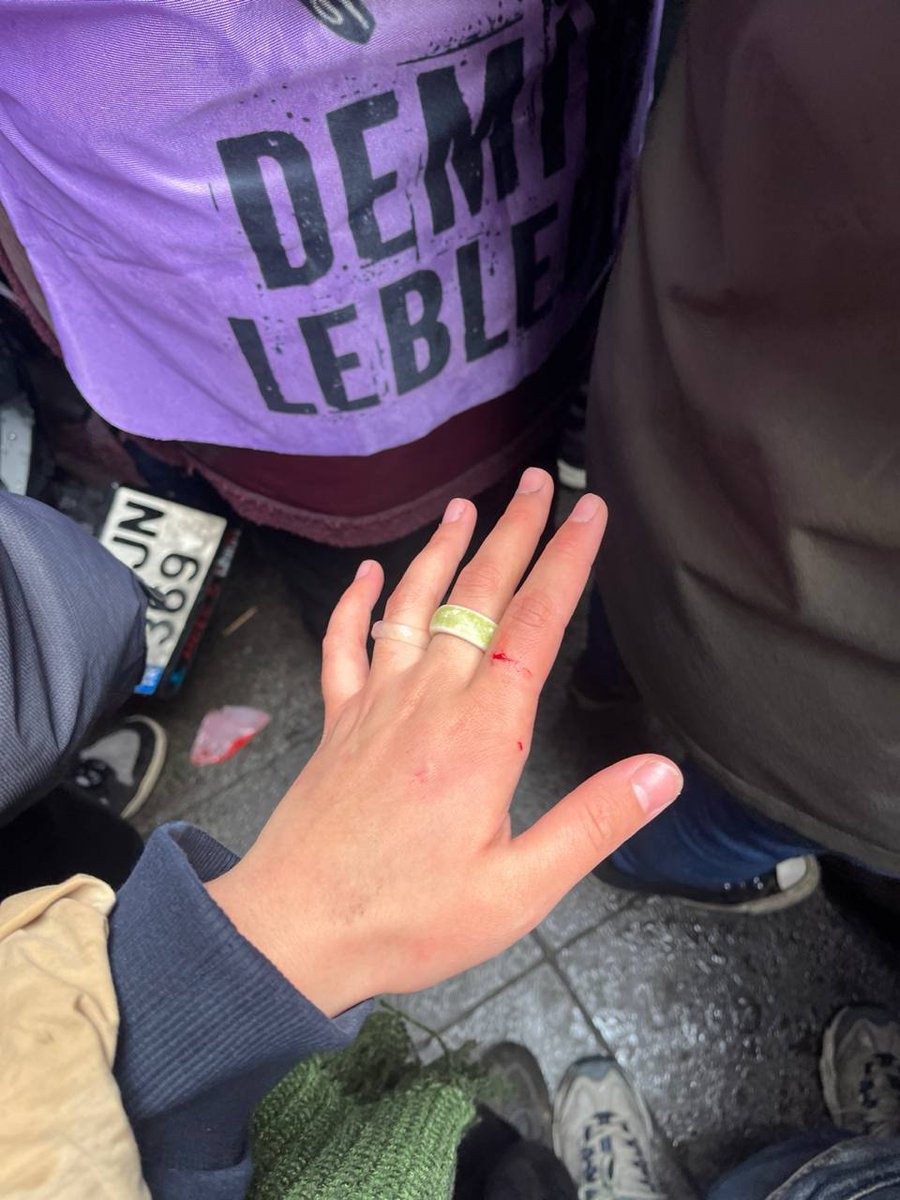 Demir Leblebi 🏳️🌈🏳️⚧️ tweet media