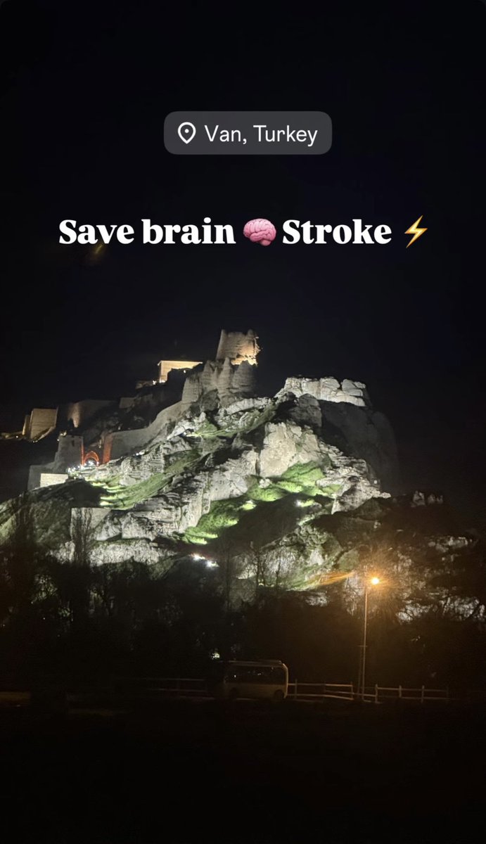 drsaim_turkoglu's tweet photo. İnme tedavisi olan olan bir hastalıktır . En önemli faktör zamanında müdahaledir . https://t.co/OSvH89tEzO