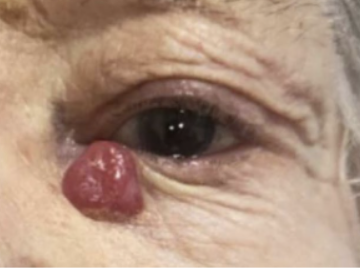 Clinical and Experimental Ophthalmology tweet media