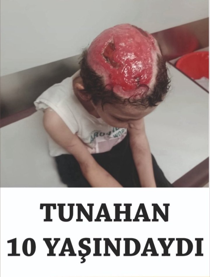 Sarachesarasara's tweet photo. @hilalustuk Bak çaki👇
#köpekciterörü
#TunahanYılmaz
#eslemteker
#ranaelselci
#RukenKolcu
#MehmetÖzer
#DuduBerk
#MahraMelinPınar
#MustafaErçetin
#MehmetÖzer
#metedurna https://t.co/DlxF8pQVgf