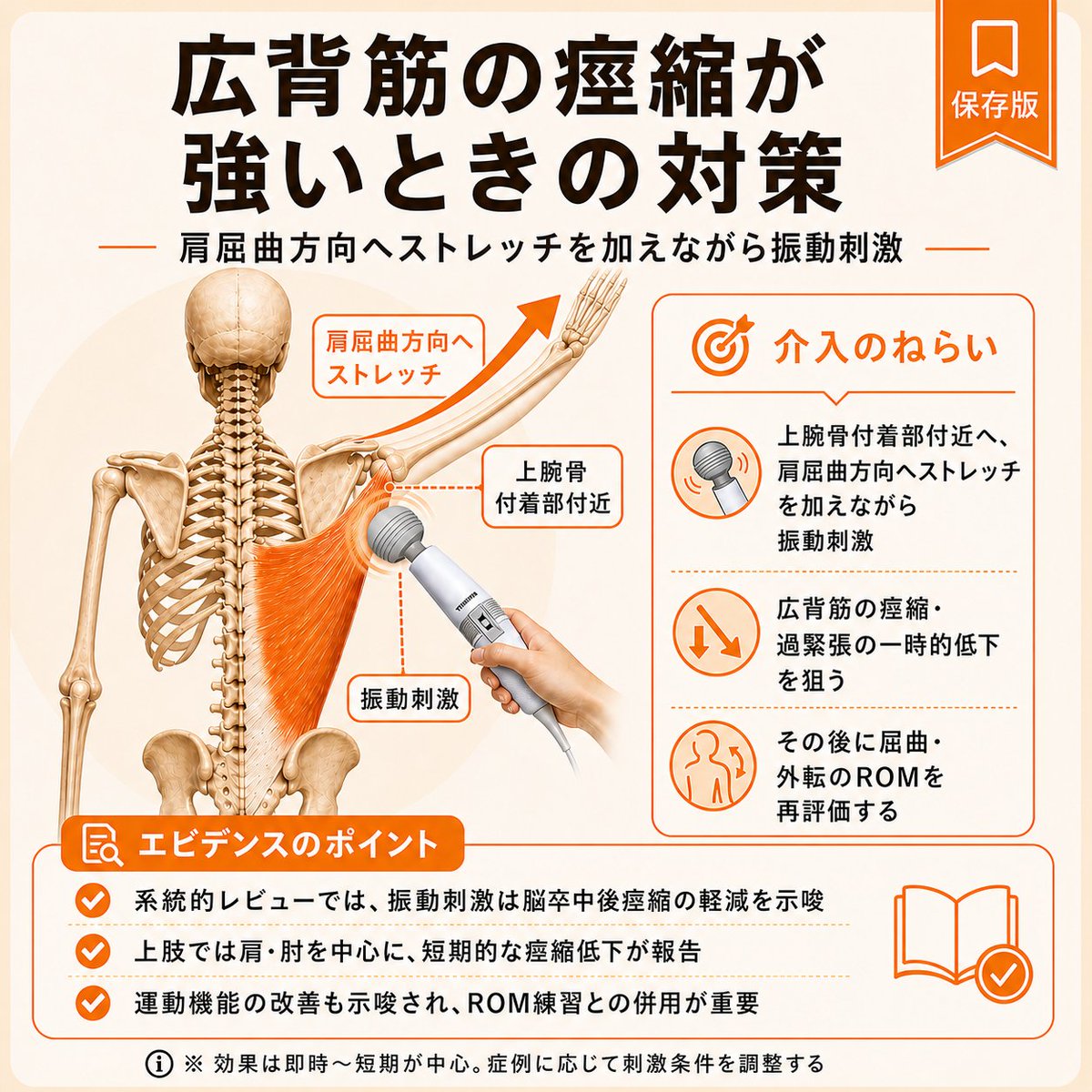 takshi_77's tweet photo. 脳卒中後、肩関節が上がりにくくなる事があります。その原因の一つに広背筋の筋緊張の亢進（痙縮）の影響があります。そんな際は肩関節内旋を伴わず、痛みを感じない範囲まで肩関節屈曲しつつ、広背筋上腕付着部付近に振動刺激を当てると、肩関節の可動域が広がることがありますので、確認しましょう https://t.co/oTNVb3mvDl