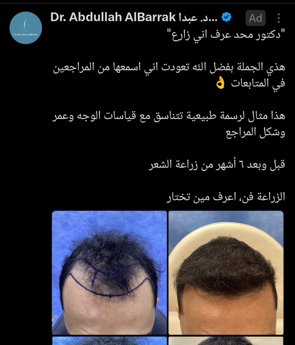 Goblet SBR 🪻💜💙 tweet media