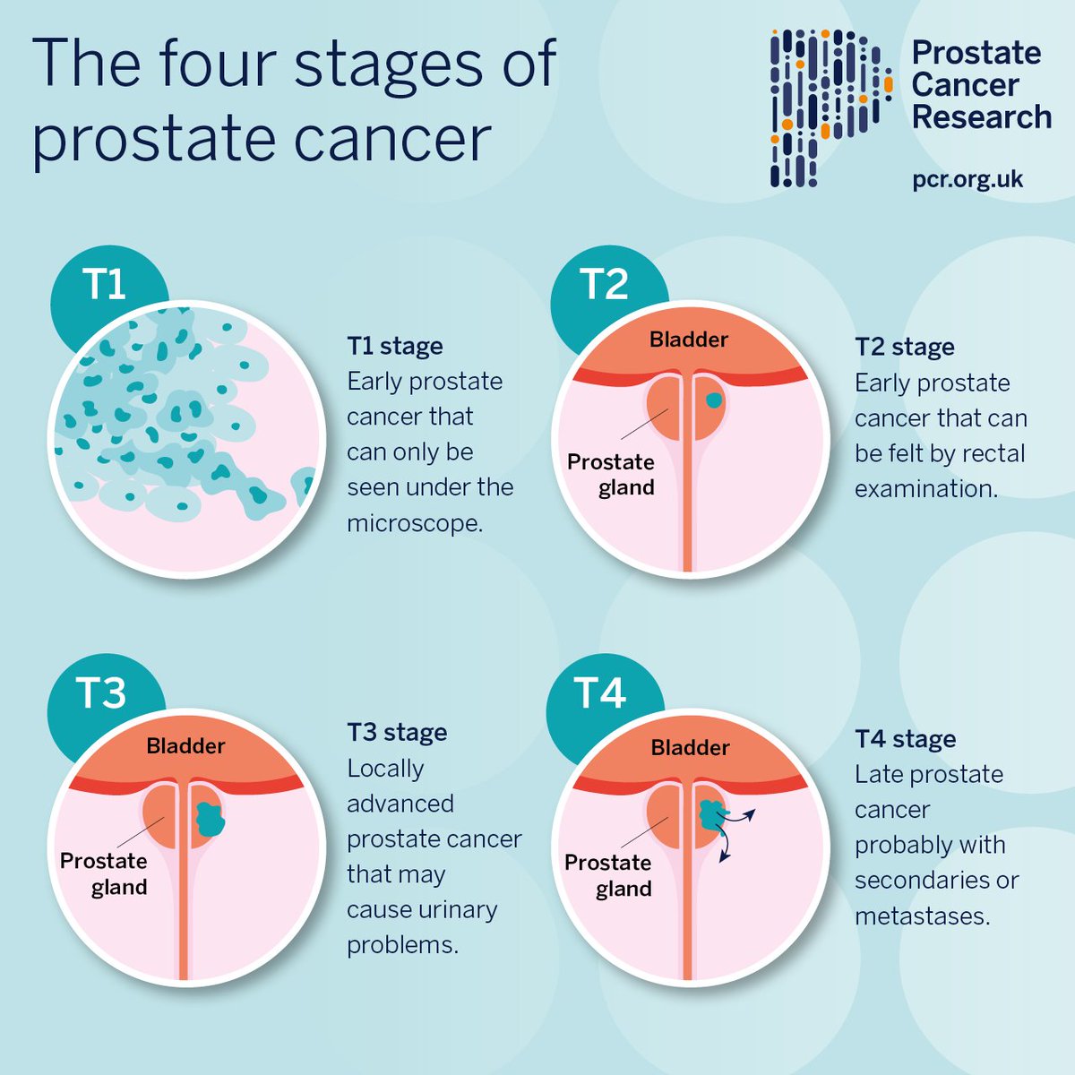 ProstateCancerResearch tweet media