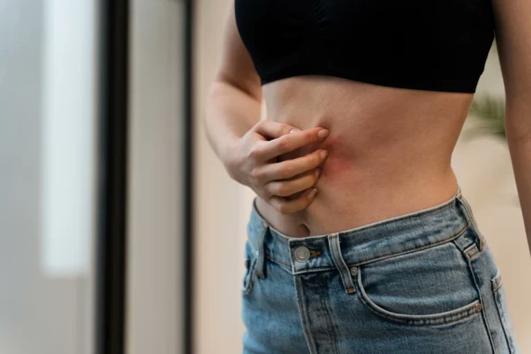 Federa26's tweet image. Your skin reflects your gut health. Chronic breakouts or irritation could be signs of a "leaky gut" allowing toxins into your bloodstream. Fix the root cause to achieve a clear, healthy glow from the inside out. ✨🧴

federa.org/gut-health/ski…

#LeakyGut #SkinHealth