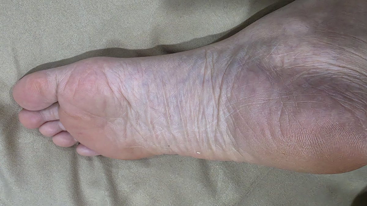 sexysoleslegs tweet media
