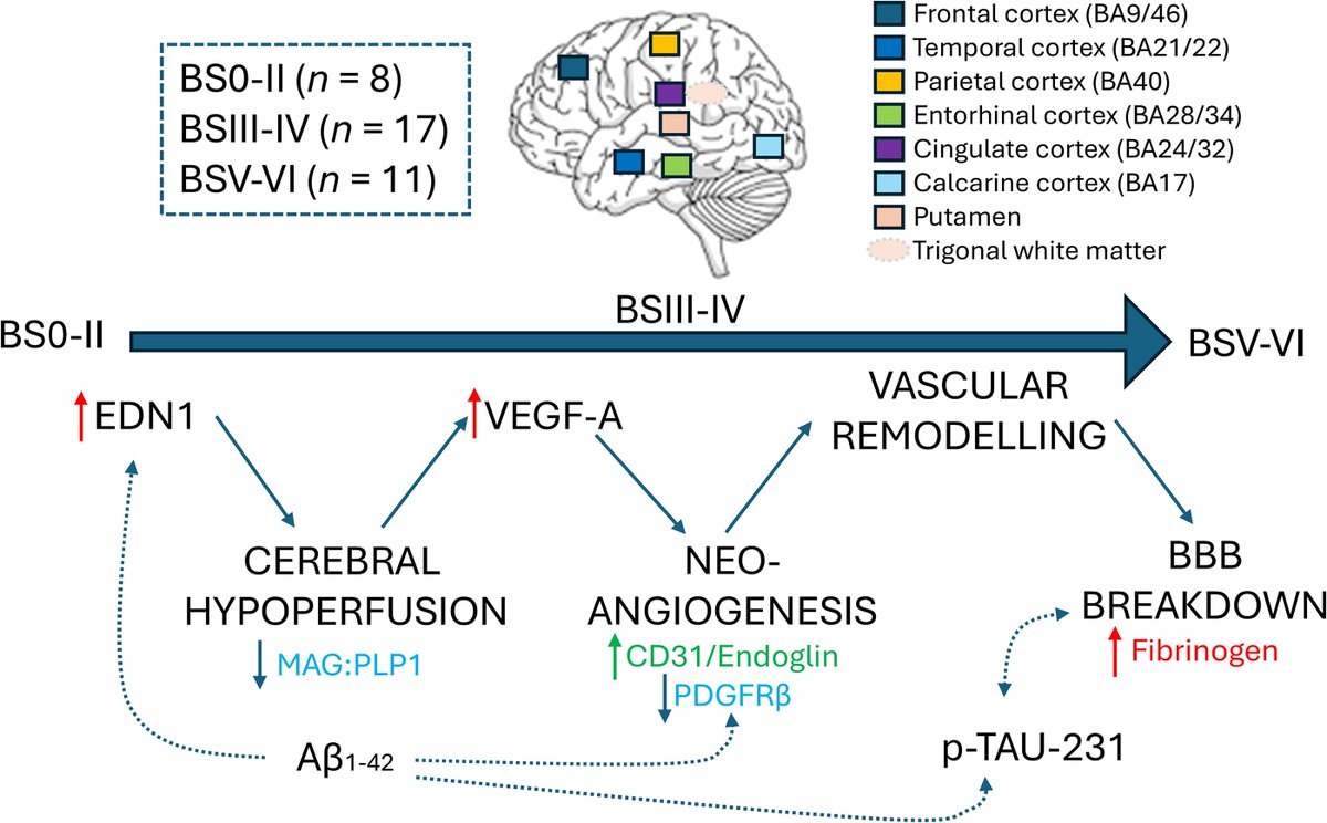Brain1878's tweet photo. By analysing post-mortem brain tissue, Asby et al. show that reduced blood supply in AD promotes the growth of new but leaky blood vessels. These vascular changes are widespread even in early disease stages. https://t.co/srqeQlJQBG; https://t.co/MD6eAlo8KJ https://t.co/6eL6l6T1TP