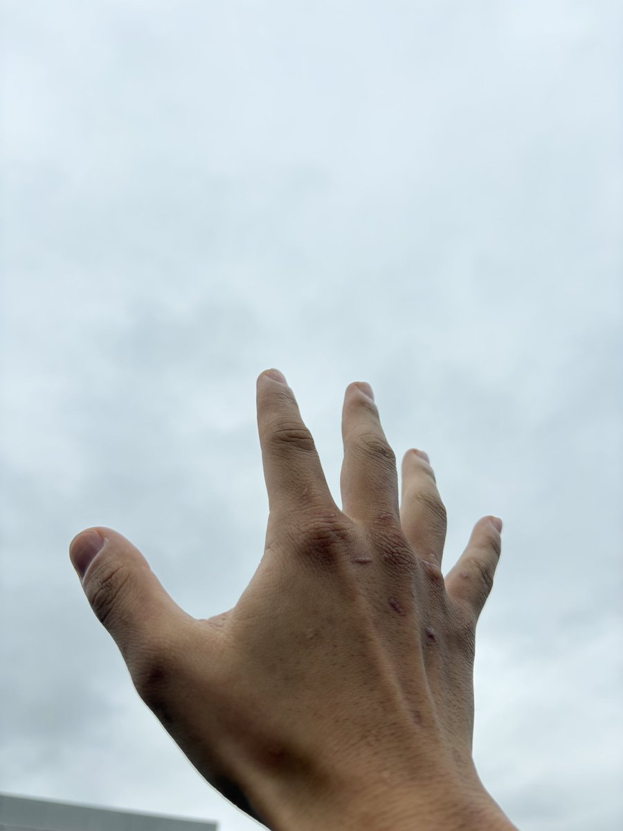 雨っち嫌いじゃないっちゃんね☔️

減量することで食べ物を食べたり
飲めることのありがたみが
分かるように、
雨が降るからこそ晴れた日に
外に出られることの楽しさが
分かるっちゃん😊

カエルとか植物は雨が好きやもんね🐸
#1日1回方言ツイート