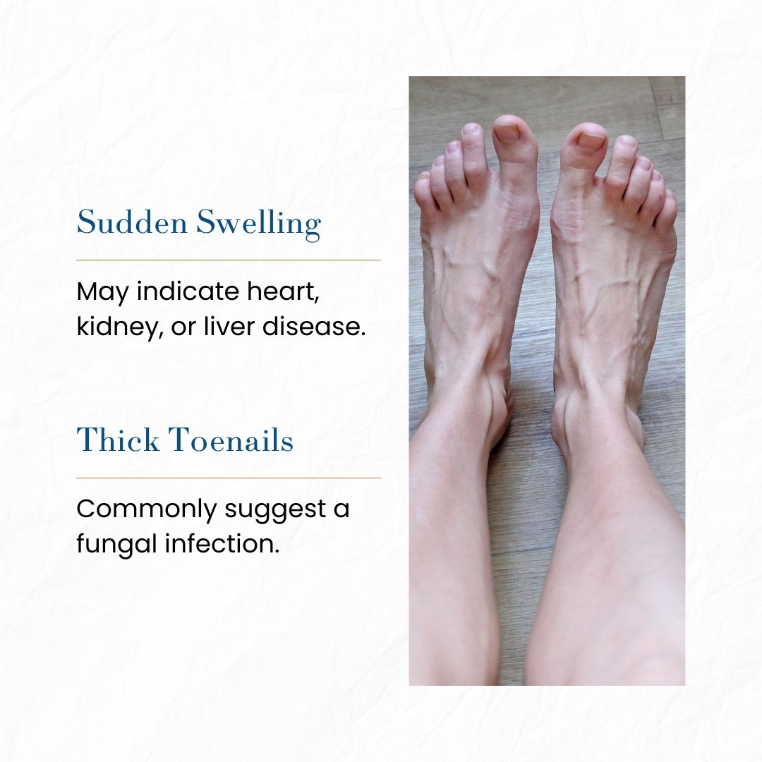 MidwestAnd56694's tweet image. Ever noticed unusual changes in your feet? From cold toes to sudden swelling, your feet reveal hidden health concerns. Pay attention to these subtle signs—they might be your body’s way of asking for care and attention.
#FootHealth #HealthAwareness #HealthyLiving #WellnessTips