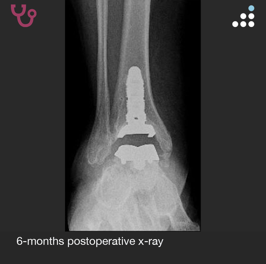 Orthobullets tweet media