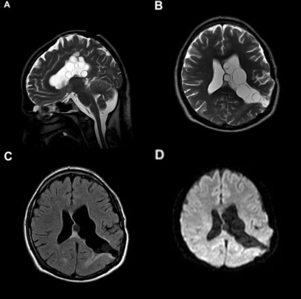 Practical Neurology tweet media