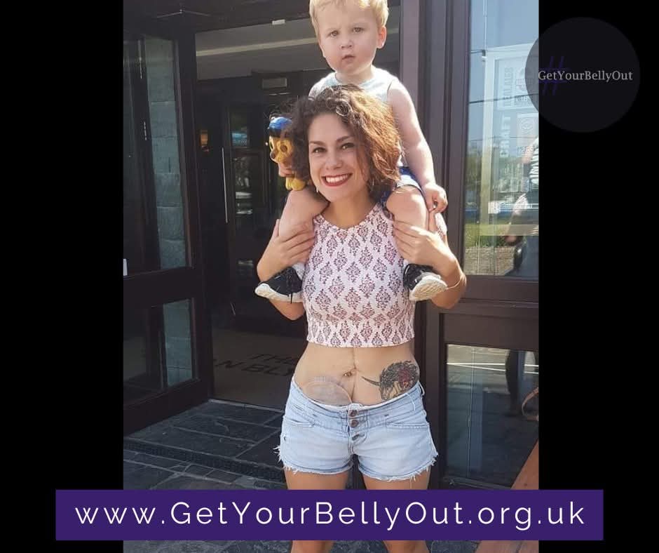 #GetYourBellyOut tweet media