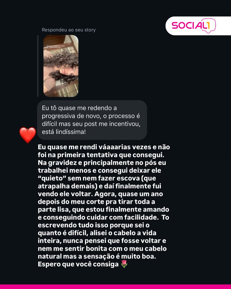 blogsocial1's tweet image. 🌀✨ Manu Gavassi comemorou o fim da sua transição capilar após um ano de processo. A cantora confessou que quase desistiu e voltou para a progressiva, mas resistiu: "Não acredito que cheguei aqui!".

📸 Reprodução / Instagram / manugavassi

#manugavassi #famosos *lm