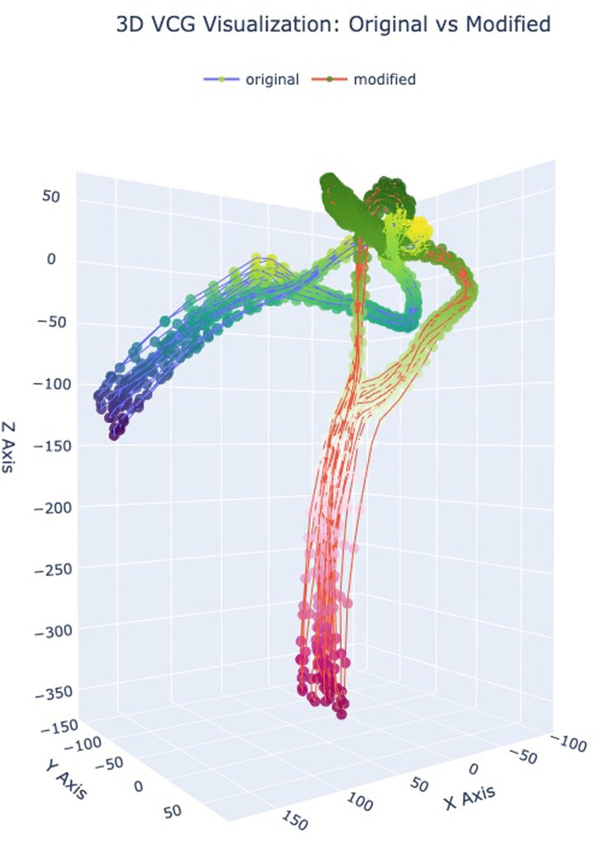 HRS_O2Journal's tweet image. Self-supervised contrastive learning enables robust electrocardiogram-based cardiac classification
@uusci @UofUECE @NEH_CVRTI @UtahBME @DenverHealthMed @CUDeptMedicine #EPeeps
heartrhythmopen.com/article/S2666-…