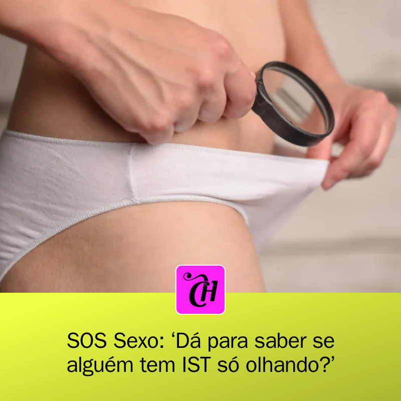CAPRICHO's tweet photo. 🚨🔍 É possível saber se alguém tem IST apenas olhando? A ginecologista Juliana Teixeira revela que algumas infecções como herpes e HPV têm sinais visíveis, mas isso não é regra! Exames são cruciais! Fique atento! #SaúdeSexual #IST #SOSSexo
https://t.co/f8jsaYSyhr https://t.co/ij01vhTXdU