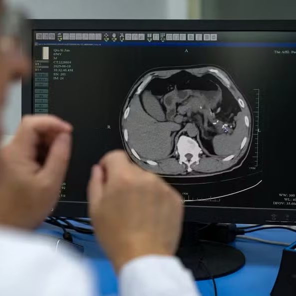 🚨 O ANO DA CIÊNCIA! Inteligência Artificial consegue detectar sinais de câncer de pâncreas ANOS ANTES do diagnóstico.
