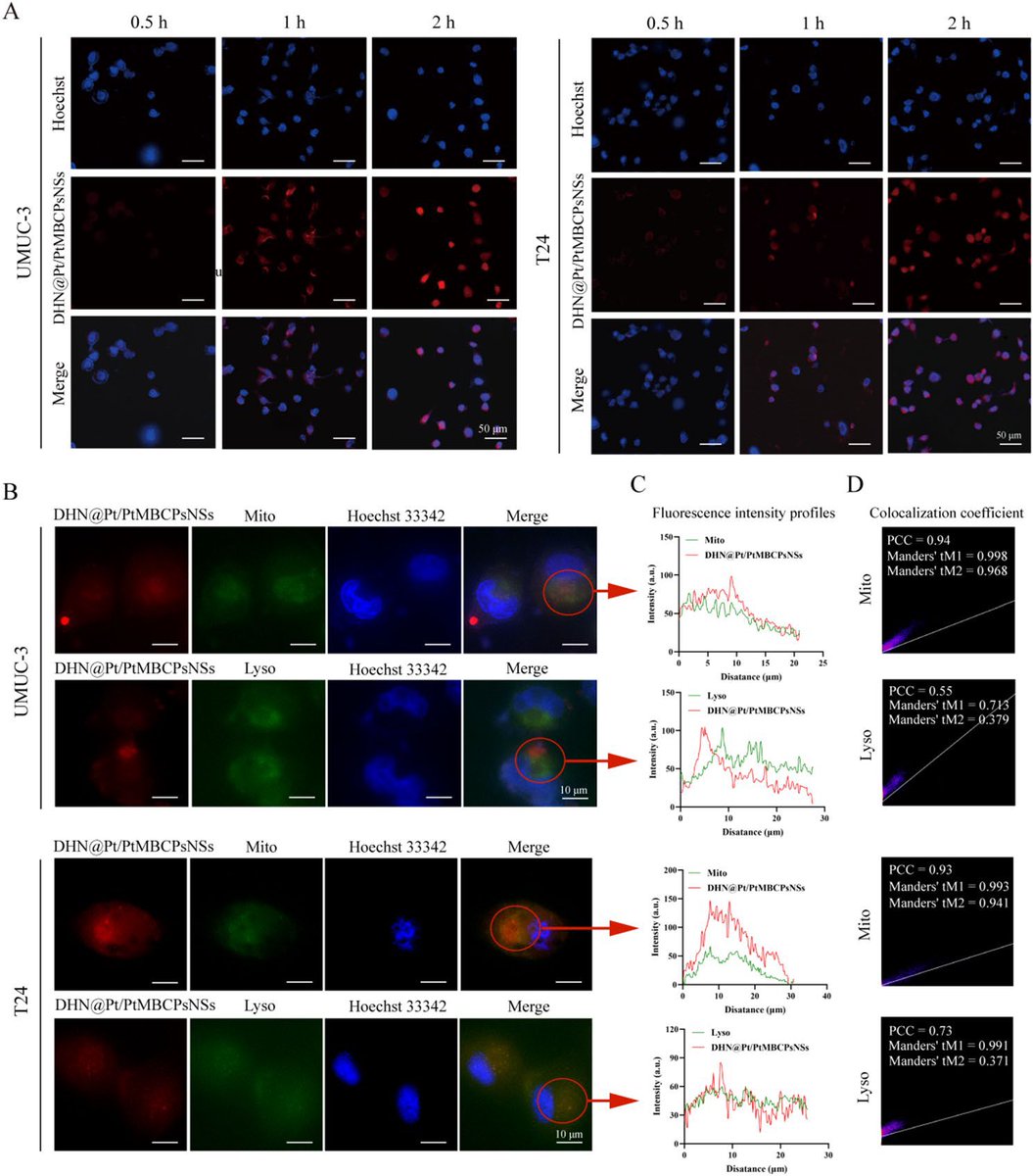 LiangChengMD's tweet photo. Excited to share two recent high-impact publications from Dr. Zhiping Wang’s lab, and truly honored to be part of these important studies advancing the landscape of precision oncology and FGFR3-targeted therapy in bladder cancer.

In our Advanced Science study (PMID: 41168906, journal impact factor, 14), Dr. Wang and colleagues developed a novel FGFR3-targeting antibody–drug conjugate (ADC) delivering a potent camptothecin derivative (A2) directly to tumor cells. Beyond precise targeting, this work uncovers a compelling mechanism - activation of the cGAS - STING pathway, linking targeted therapy with innate immune signaling. The ADC demonstrated strong efficacy in patient-derived organoids and xenograft models, including chemotherapy-resistant disease, with a favorable safety profile.

Complementing this, our Journal of Nanobiotechnologystudy (PMID: 41275281, journal impact factor, 12) introduces a precision nanotherapeutic platform enabling ultrasound-triggered intratumoral generation of cytotoxic agents. This innovative system integrates sonodynamic therapy, redox modulation, and programmed cell death (including pyroptosis), achieving spatially controlled tumor targeting while minimizing systemic toxicity.

Together, these studies highlight key advances in bladder cancer therapeutics: • Transition from conventional targeting to precision delivery platforms (ADC, nanomedicine) • Integration of mechanistic biology with therapeutic design (STING activation, oxidative stress, pyroptosis) • Overcoming resistance through multimodal and microenvironment-responsive strategies • Expanding the clinical relevance of FGFR3 as a key actionable target

Precision oncology is clearly entering a new phase -driven not only by molecular targets, but by innovative therapeutic engineering and deeper biologic insight.

Grateful to be part of these outstanding collaborative efforts in advancing precision care of bladder cancer patients.