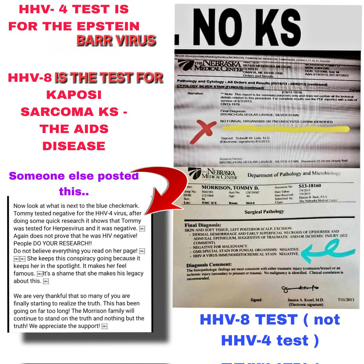 trisha_tommy's tweet image. #FOR #CLARIFICATION ..SOMEONE IS APPARENTLY questioning the testing done on TOMMY.

♥️The TEST RESULT I POSTED WAS ON THE #HHV-8 #TEST WHICH RESULTED IN A #NEGATIVE TEST RESULT FOR #KP - KAPOSI SARCOMA. The Kansas City Star reporter Sam Mellinger reported ..#worldwide..back in
