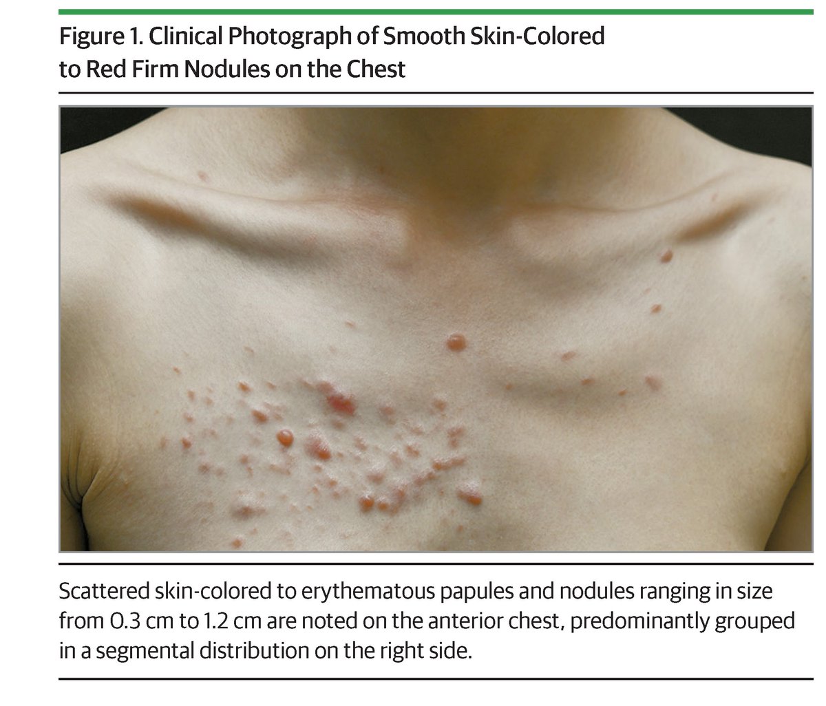 JAMA Dermatology tweet media