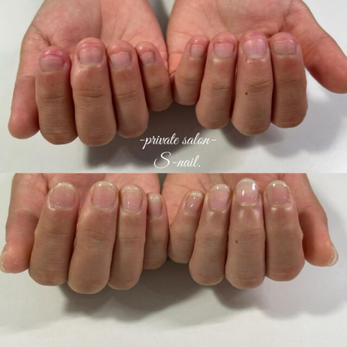 nail_private's tweet photo. 手の深爪や爪トラブルにお悩みの方。プライベート空間で丁寧なカウンセリングとお客様に適した施術を行います

健康的に爪を整え自信が持てる指先に。あなたの魅力を引き出すお手伝いをさせて下さい

https://t.co/sxfvI9nP0G
https://t.co/Iww1kKMfVQ

#深爪矯正 #メンズネイル https://t.co/Gn7hloOAWQ