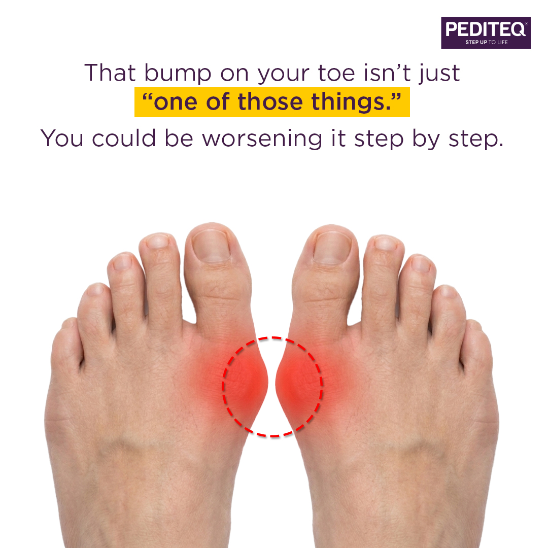 pediteq's tweet image. The solution starts simple: roomy shoes, aligned toes, and support that actually works. Find the better answer to everyday foot discomfort with Pediteq.
Visit: pediteq.com

(Comfort footwear for diabetics, diabetic foot, footheath, style)

#shoes #diabetes #bloodsugar