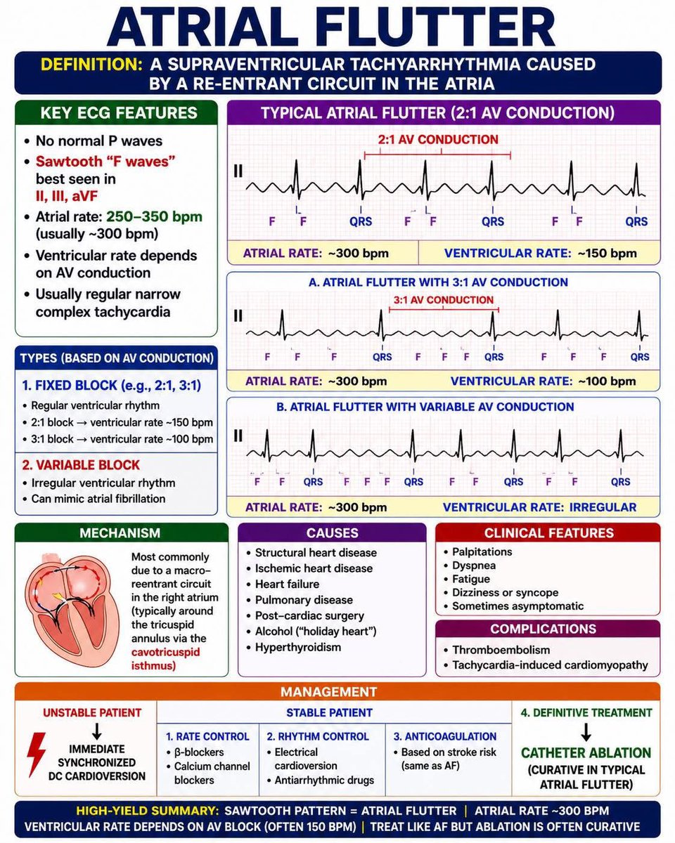 DrRafiulla's tweet image. Atrial flutter

#medtwitter #medED