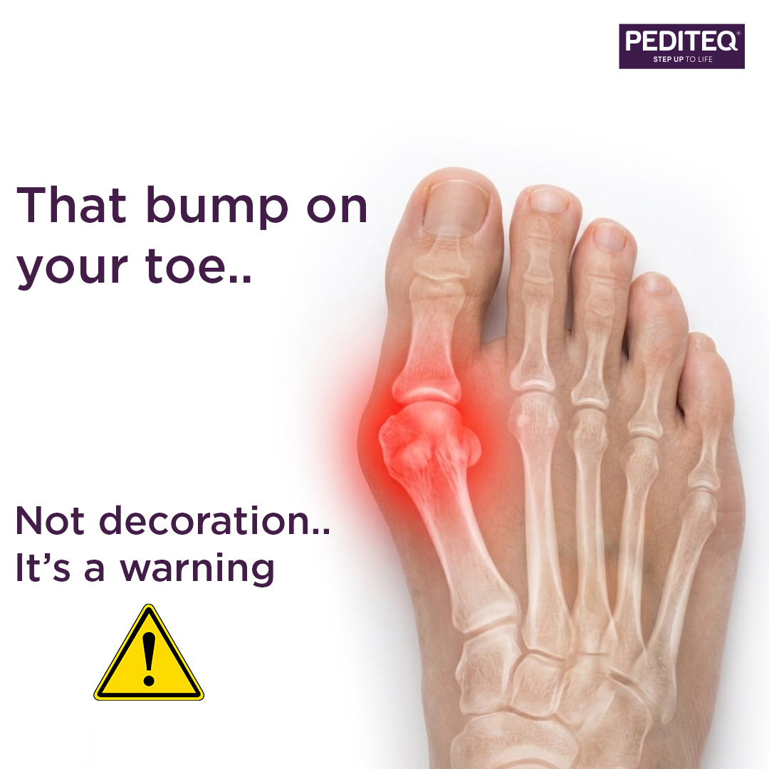 pediteq's tweet image. The solution starts simple: roomy shoes, aligned toes, and support that actually works. Find the better answer to everyday foot discomfort with Pediteq.
Visit: pediteq.com

(Comfort footwear for diabetics, diabetic foot, footheath, style)

#shoes #diabetes #bloodsugar