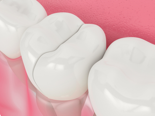 gzirakiandmd's tweet image. Watch this video to learn more about materials and techniques we use to repair and rebuild damaged or cracked teeth. #eastlongmeadow #dentist bit.ly/48bIPBv