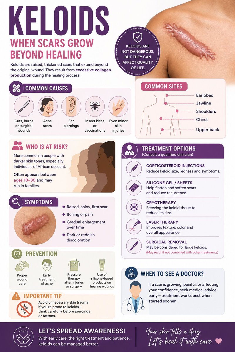 ayebaredalton7's tweet image. A scar that keeps growing?
Itching, raised, spreading beyond the wound?
You might be dealing with a keloid. 👇
#MedicalEducation #SkinCare