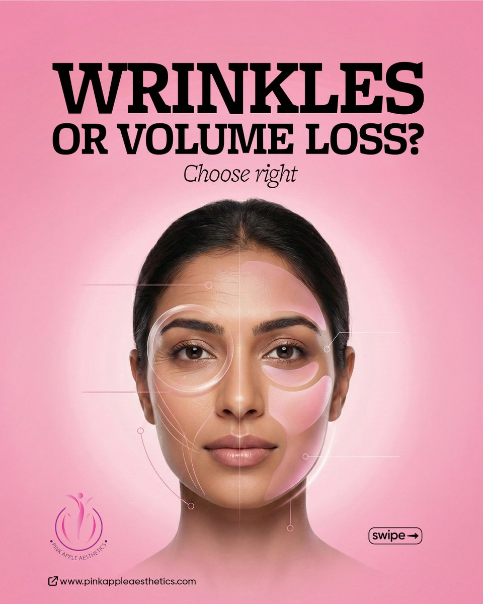 PinkyAesthetics's tweet image. Wrinkles or volume loss? 🤔
Not all aging concerns are the same—and neither are the treatments.

Choosing the right one makes all the difference in achieving natural, balanced results.

👉 Swipe to understand what your skin really needs.

#PinkAppleAesthetics #Bangalore #Botox