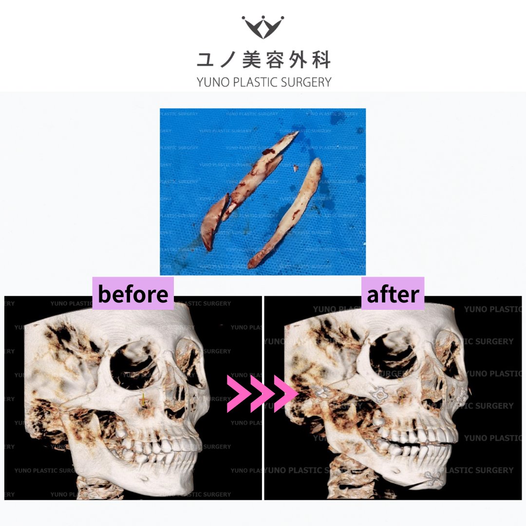 ユノ美容外科 👑 公式 tweet media