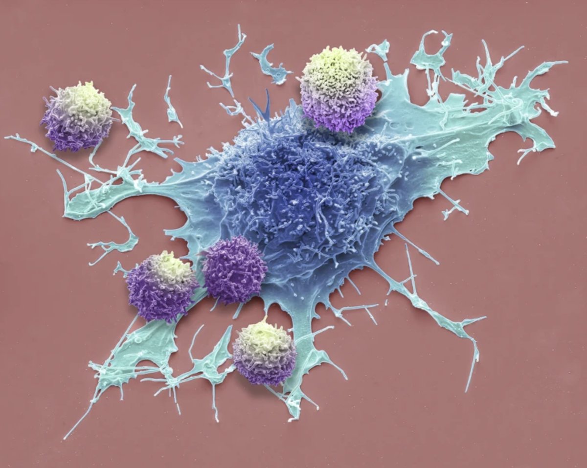 manuelacasasoli's tweet image. Promising results against cancer...

"The first clinical trial to test the tumour-fighting power of a stem-cell-like class of long-lived immune cells suggests that they could be more potent and less toxic than the standard mix of cells used in therapies for cancer."

#Science