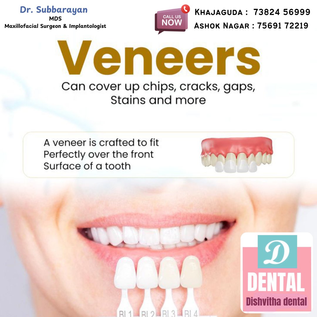 DDishvitha's tweet image. Best Dental Hospital In Ashoknagar - Hyderabad. #ashoknagar #hyderabad #narayanguda #himyathnagar #chikkadpally #rtcxroads #hyderabaddentist #dentalhyderabad #hyderabaddentalclinics #dentalclinicsofhyderabad #domalguda #secunderabad #indirapark_hyd #IndiraPark #khajaguda