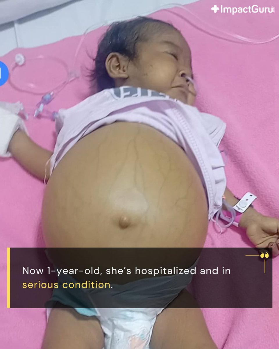 ImpactGuru's tweet image. At just 1 year old, when she should be taking her first steps, Numahangma is fighting for her life. She urgently needs a liver transplant to survive, but her parents cannot bear this fight alone.

Please donate and give her a chance at life: impactguru.com/s/gK0qS0

#SaveLives