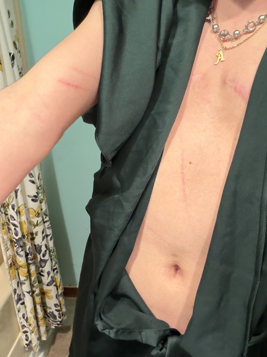 greeniexcx's tweet photo. “What was that? I don’t care if your legs are numb I didn’t say stop. Say yes sir.” 

And I have 3 different belts restraining my legs, arms and neck… Dear god do not save me I am exactly where I want to be

#murrsuit #ftm https://t.co/3kCYuifSWh