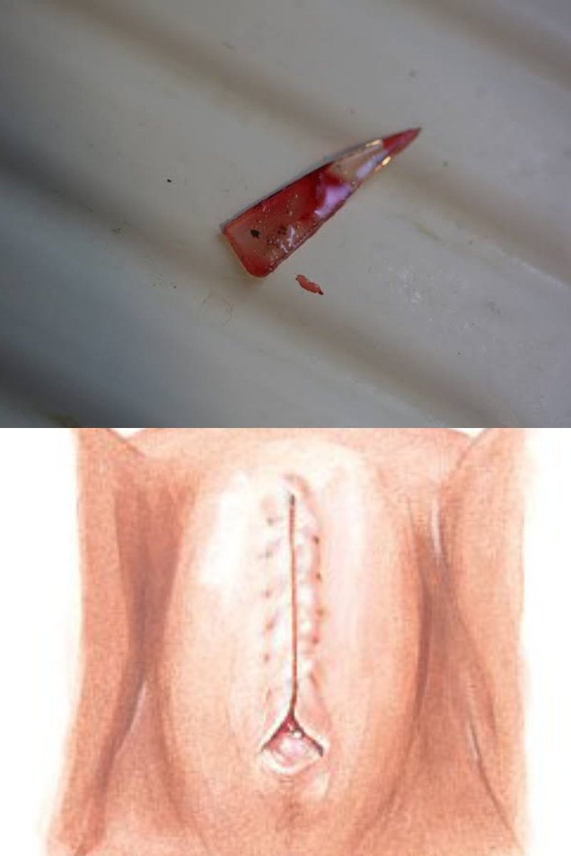 thegirdlengr's tweet photo. My #FGM Torture
"I Was Circumcised Twice (8 And 13 Years Old); Second Time Was Because Some Soldiers Raped Me A Girl Told Me She Was Circumcised With A Broken Glass!" 

Ifrah Ahmed Recounts:
"When I was 8 years old, I was circumcised by my grandmother's brother; he was a doctor. https://t.co/uIFuoGpHen