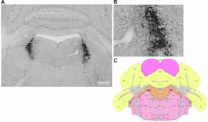 RobyChil's tweet image. La #minociclina ha un effetto simile al #clonazepam, il farmaco #anti-panico più comunemente prescritto

Uno studio dimostra che piccole dosi dell'antibiotico minociclina potrebbero essere utili nel trattamento degli di #attacchi di #panico…

Link: thesolver.it/la-minociclina…