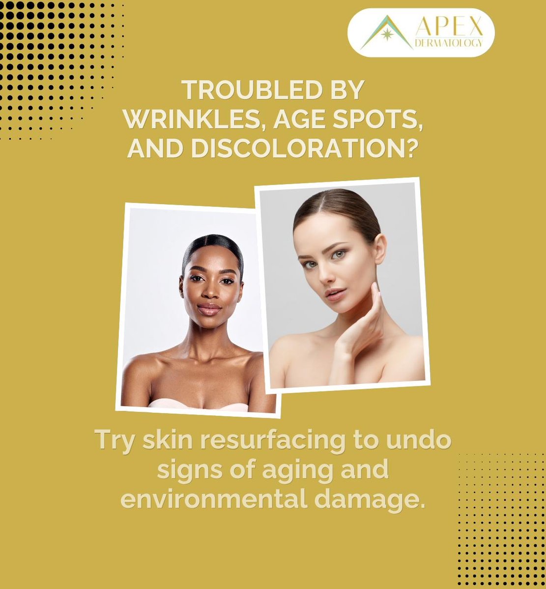 apex_derm's tweet photo. Skin resurfacing treatments are non-surgical and remove damaged outer layers of the skin to reveal smoother, healthier skin. They improve signs of aging with minimal downtime.
.
.
.
https://t.co/uOyh8Bc3q9
818-889-2739 https://t.co/wQqbCqfLiQ