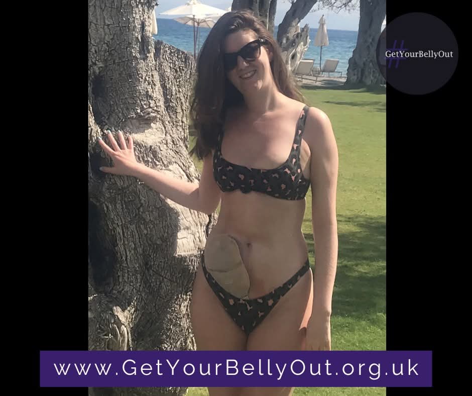 #GetYourBellyOut tweet media