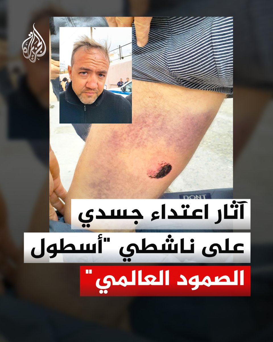 AJArabic's tweet image. ندبات وجروح وكدمات.. "أسطول الصمود العالمي" يندّد بالاعتداء الوحشي على ناشطيه في المياه اليونانية، ويحمّل سلطات أثينا والقوات الإسرائيلية مسؤولية سلامتهم
#ألبوم