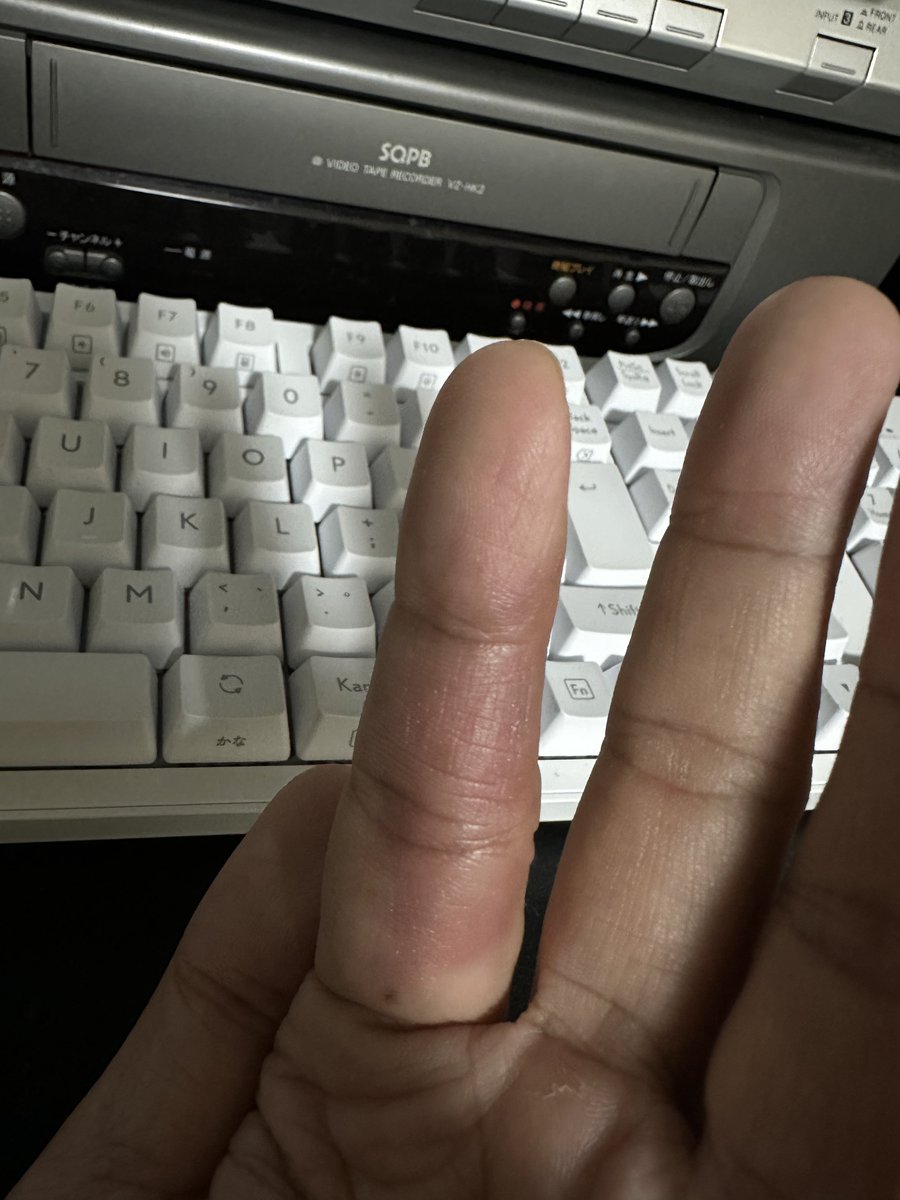 director_4K's tweet photo. 写真だとわかりづらいですが、指を強打して青紫になって尋常じゃない痛みなうです。
何の薬が効きますか？
冷やす？温める？湿布？バンテリン？ https://t.co/wpgk8KchvL