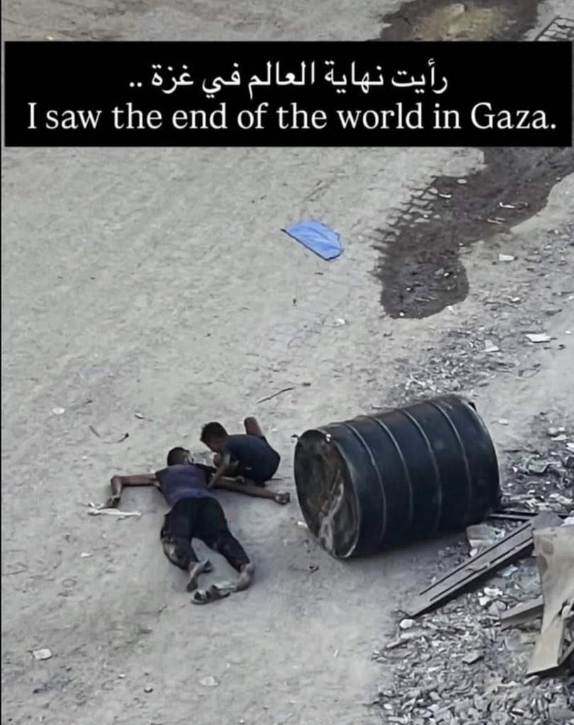 Dr.Hamza Alsharif 🇵🇸 tweet media