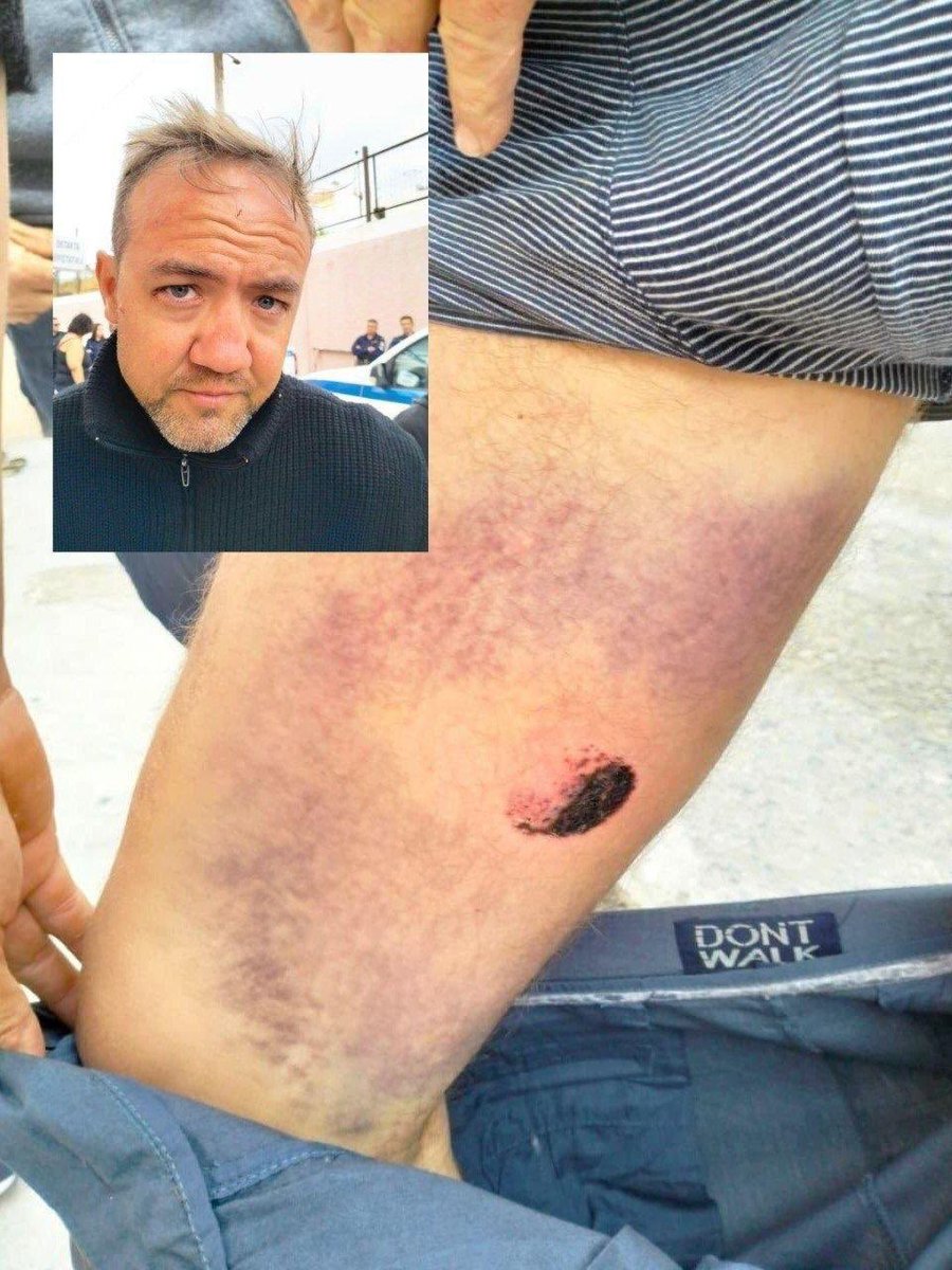 NUNUCOINnunu's tweet image. BREAKING: PRESS TV @PressTV  Just published now

Photos of Global Sumud Flotilla activists with 'visible signs of TORTURE' after detained by #Israeli Navy