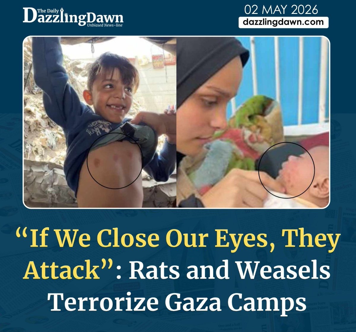 MunzerChowdhury's tweet image. Gaza health crisis rodents pests outbreak...
dazzlingdawn.com/2026/5/2/if-we…

#gaza #gazacrisis #humanitariancrisis #publichealth #who #unicef