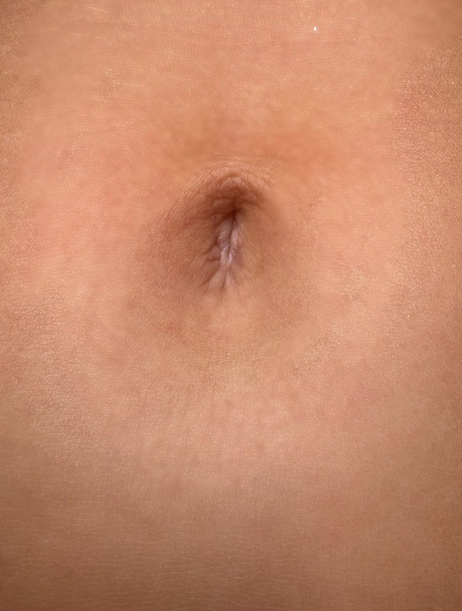 littlemissnavel's tweet photo. a close up of my belly button, so cute 🌺 #navel #bellybutton #ofcreator #midriff #bellt https://t.co/KHCn3p1jsu