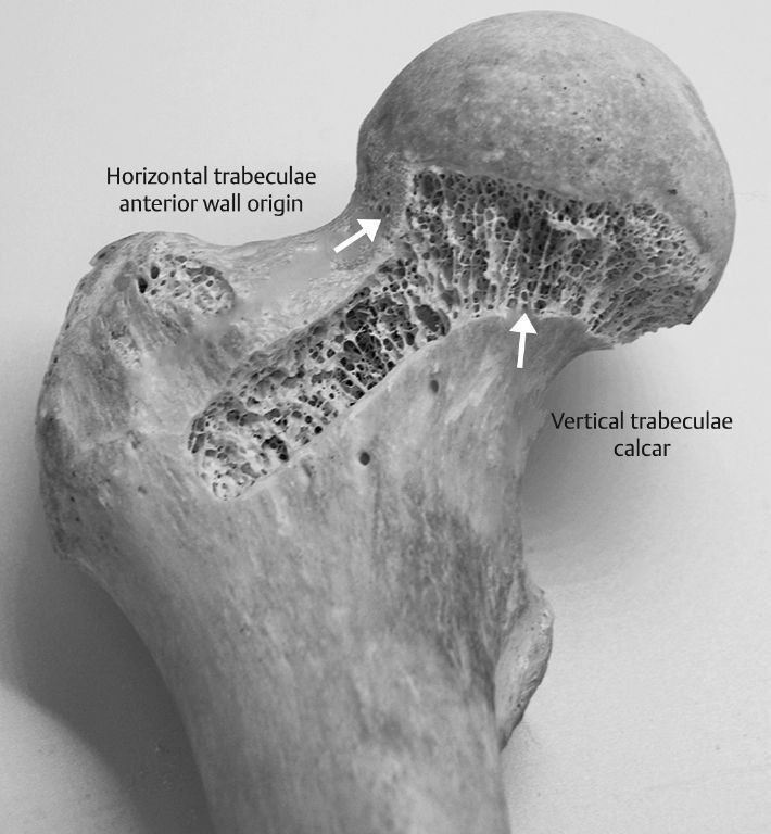 MoAImam's tweet photo. Anteroposterior Hip View: Shows the thin (2–4 mm) cortical wall and internal trabecular structure, with a vertical trabecular column (calcar) and a horizontal column extending from the anterior wall to the neck and femoral head, as described by Hammer. https://t.co/3v9dul57Gu
