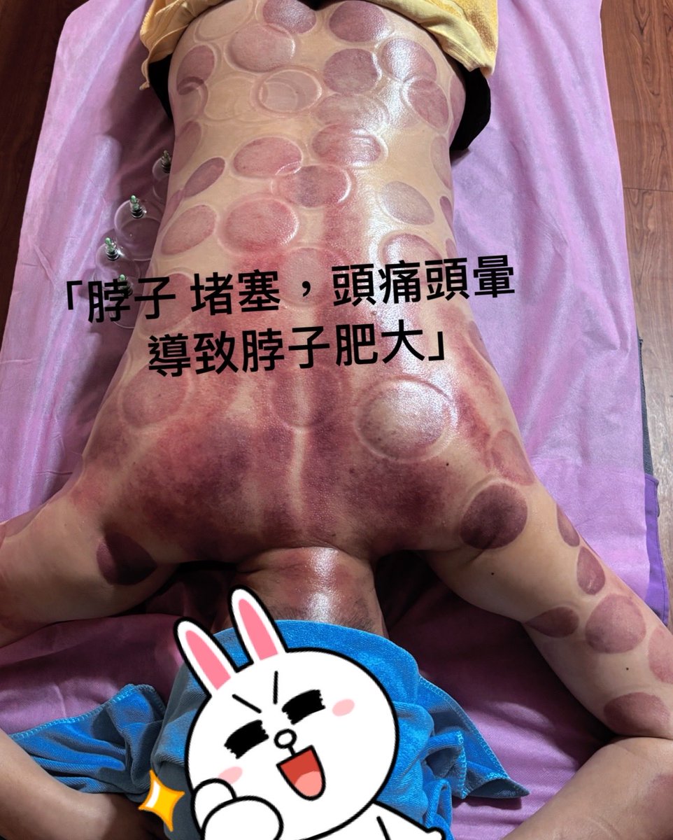 Mi guo 龍筋保健 0987699535 tweet media