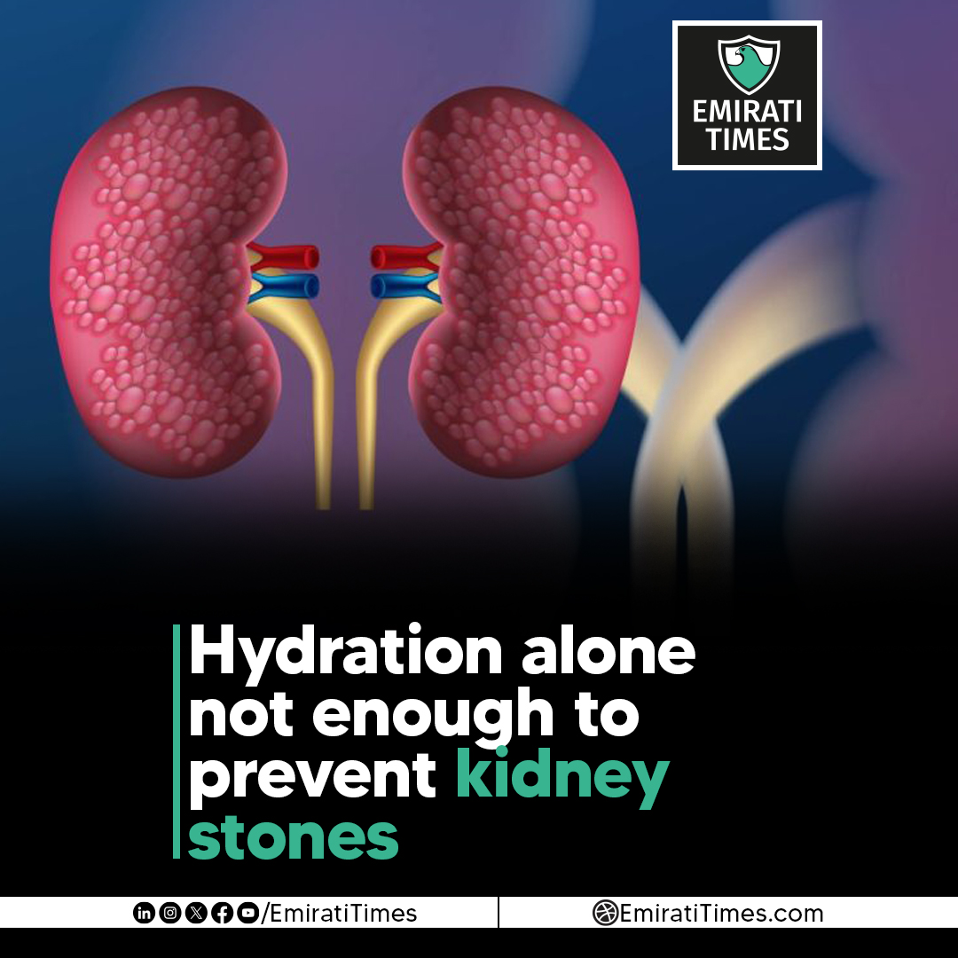EmiratiTimes's tweet image. Hydration alone not enough to prevent kidney stones
emiratitimes.com/hydration-alon…

#KidneyStones #KidneyHealth #Hydration #HealthResearch #MedicalStudy #EmiratiTimes #Urology #PreventiveHealth #ChronicCondition @DCRINews