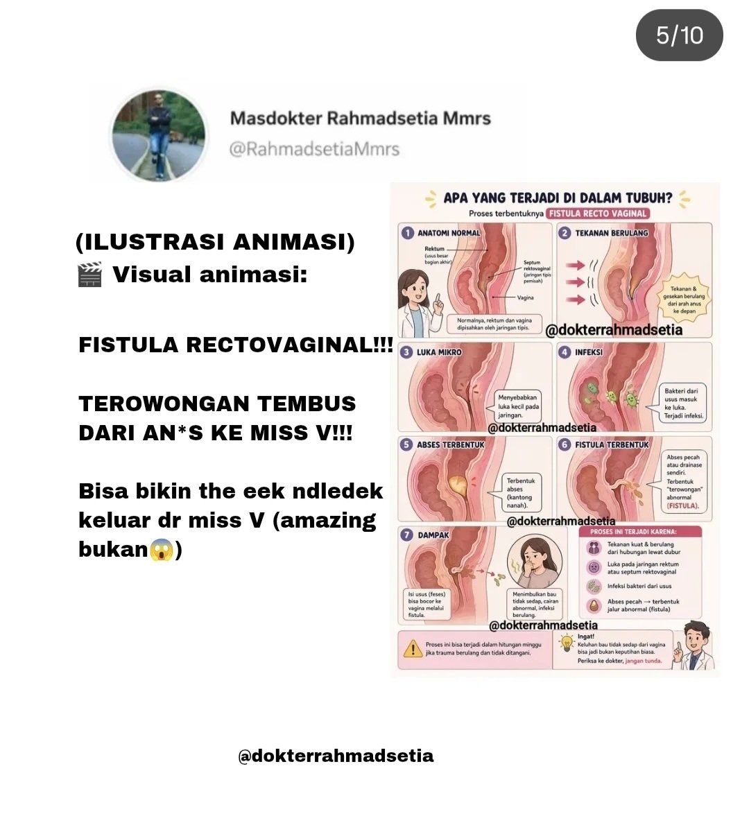 Langerhans tweet media