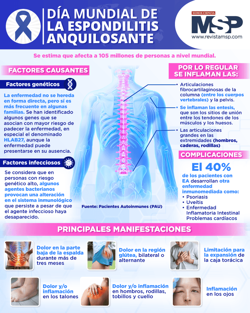 #DíaMundialDeLaEspondilitisAnquilosante Objetivo de este día es visibilizar que es una enfermedad inflamatoria crónica que afecta principalmente la columna vertebral y las articulaciones sacroilíacas, provocando dolor, rigidez y, en casos avanzados, fusión ósea (anquilosis). En